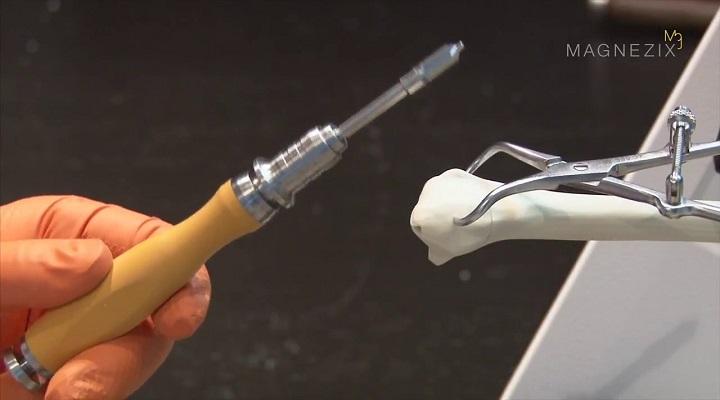 Hyphens Pharma launches Magnezix's bioabsorbable metallic implants in Vietnam