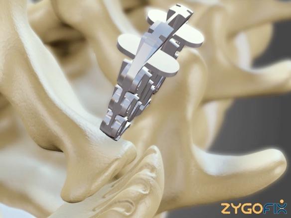 Trendlines remains undervalued and 'overweight': NRA