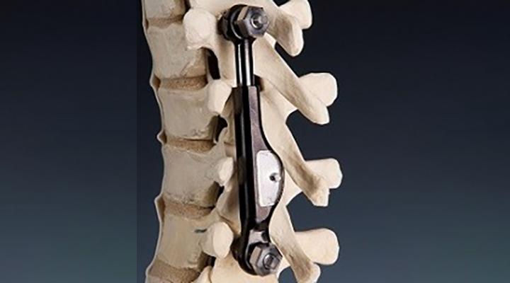 Trendlines Group sells portfolio company ApiFix to Nasdaq-listed OrthoPediatrics Corp